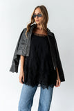 Lewis Lace Mini Dress in Black